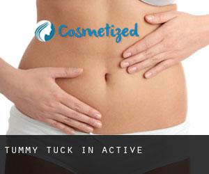 Tummy Tuck in Active
