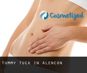 Tummy Tuck in Alençon
