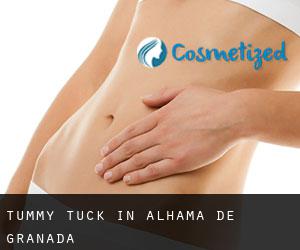 Tummy Tuck in Alhama de Granada