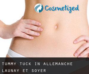 Tummy Tuck in Allemanche-Launay-et-Soyer