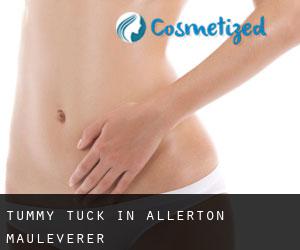 Tummy Tuck in Allerton Mauleverer