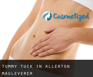 Tummy Tuck in Allerton Mauleverer