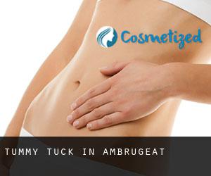 Tummy Tuck in Ambrugeat