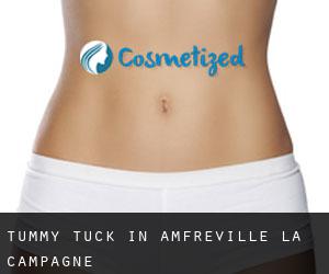 Tummy Tuck in Amfreville-la-Campagne