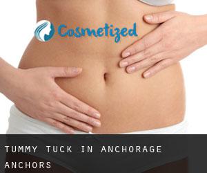 Tummy Tuck in Anchorage Anchors