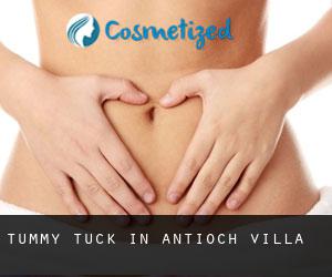 Tummy Tuck in Antioch Villa