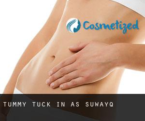 Tummy Tuck in As Suwayq Tummy Tuck in As Suwayq