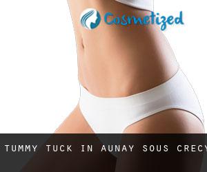 Tummy Tuck in Aunay-sous-Crécy
