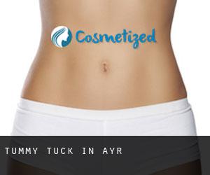 Tummy Tuck in Ayr