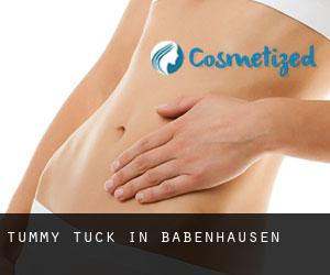 Tummy Tuck in Babenhausen