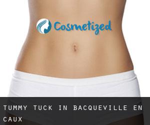 Tummy Tuck in Bacqueville-en-Caux