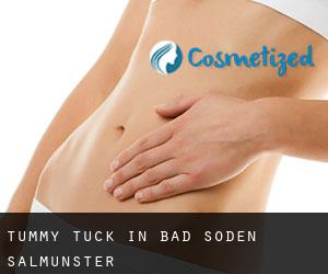 Tummy Tuck in Bad Soden-Salmünster