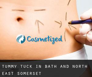 Tummy Tuck in Bath and North East Somerset