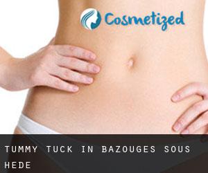 Tummy Tuck in Bazouges-sous-Hédé