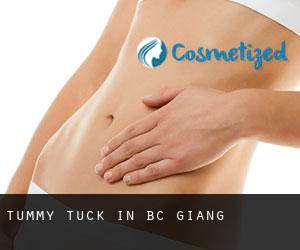 Tummy Tuck in Bắc Giang