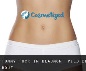Tummy Tuck in Beaumont-Pied-de-Bœuf