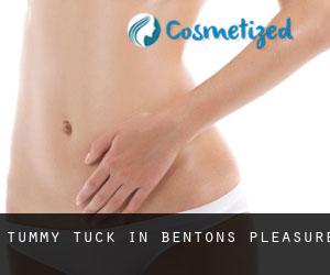 Tummy Tuck in Bentons Pleasure