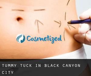 Tummy Tuck in Black Canyon City