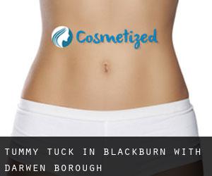 Tummy Tuck in Blackburn with Darwen (Borough)