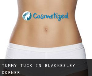 Tummy Tuck in Blackesley Corner