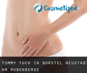Tummy Tuck in Borstel (Neustadt am Rübenberge)