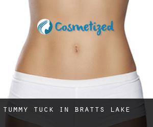Tummy Tuck in Bratt's Lake