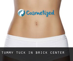 Tummy Tuck in Brick Center