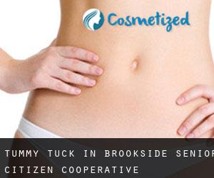 Tummy Tuck in Brookside Senior Citizen Cooperative