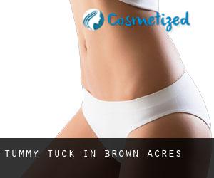 Tummy Tuck in Brown Acres