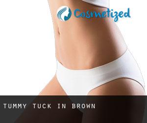 Tummy Tuck in Brown
