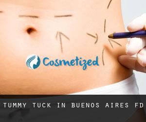 Tummy Tuck in Buenos Aires F.D.