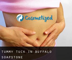 Tummy Tuck in Buffalo Soapstone