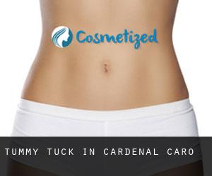 Tummy Tuck in Cardenal Caro