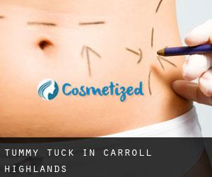 Tummy Tuck in Carroll Highlands