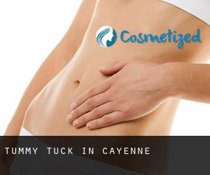 Tummy Tuck in Cayenne Tummy Tuck in Cayenne