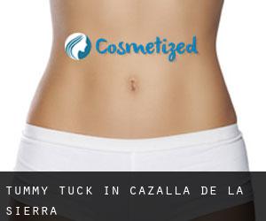 Tummy Tuck in Cazalla de la Sierra