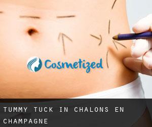 Tummy Tuck in Châlons-en-Champagne