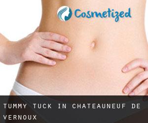 Tummy Tuck in Châteauneuf-de-Vernoux