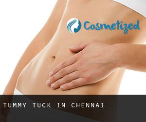 Tummy Tuck in Chennai Tummy Tuck in Chennai