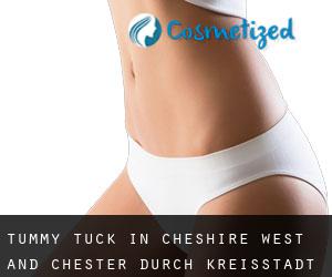Tummy Tuck in Cheshire West and Chester durch kreisstadt - Seite 2