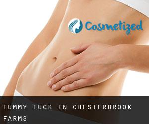 Tummy Tuck in Chesterbrook Farms