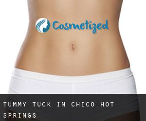 Tummy Tuck in Chico Hot Springs