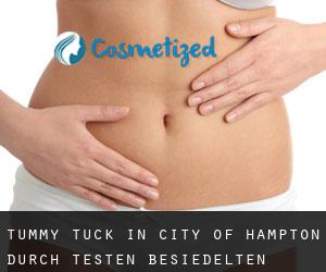 Tummy Tuck in City of Hampton durch testen besiedelten gebiet - Seite 1