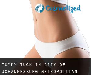 Tummy Tuck in City of Johannesburg Metropolitan Municipality