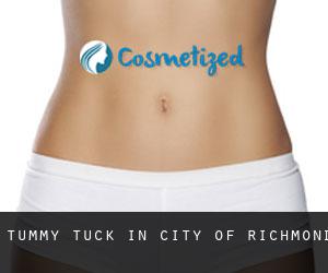 Tummy Tuck in City of Richmond