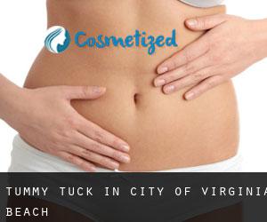 Tummy Tuck in City of Virginia Beach