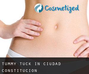 Tummy Tuck in Ciudad Constitución
