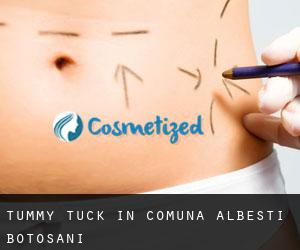 Tummy Tuck in Comuna Albeşti (Botoşani)