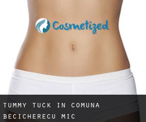 Tummy Tuck in Comuna Becicherecu Mic