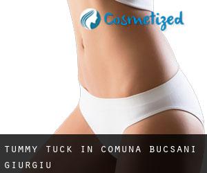 Tummy Tuck in Comuna Bucşani (Giurgiu)